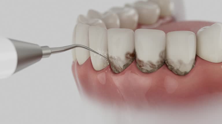 Reliable Dental Implants contractor in Vivian, LA by Smile Center Dentistry